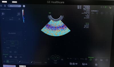 4D Ultrasound&nbsp;|&nbsp;GE&nbsp;|&nbsp;Voluson Swift BT23
