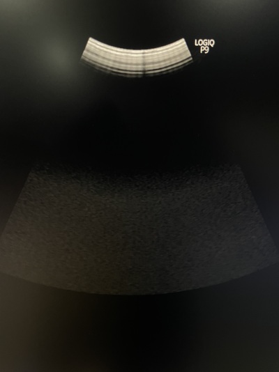 Ultrasound&nbsp;|&nbsp;GE&nbsp;|&nbsp;LOGIQ P9