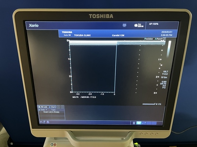 Color Doppler&nbsp;|&nbsp;CANON&nbsp;|&nbsp;TUS-X100 Xario 100