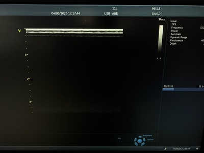 Ultrasound System&nbsp;|&nbsp;GE&nbsp;|&nbsp;Vivid S60N