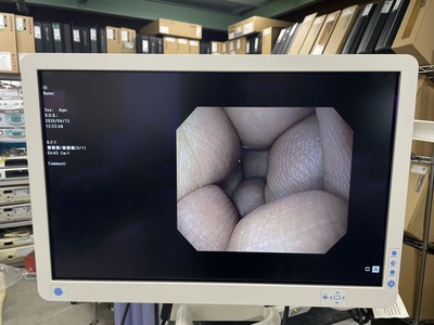 Video Gastroscope&nbsp;|&nbsp;OLYMPUS&nbsp;|&nbsp;GIF-Q150X