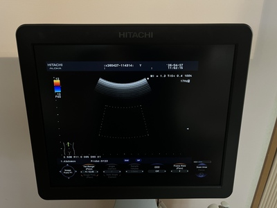 Color Doppler&nbsp;|&nbsp;HITACHI&nbsp;|&nbsp;F37
