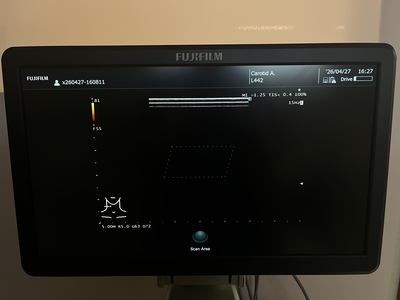 Ultrasound System&nbsp;|&nbsp;FUJIFILM&nbsp;|&nbsp;ARIETTA 50