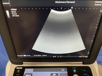 Portable Ultrasound&nbsp;|&nbsp;FUJIFILM&nbsp;|&nbsp;FC1-X