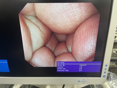 Video Gastroscope&nbsp;|&nbsp;OLYMPUS&nbsp;|&nbsp;GIF-H290