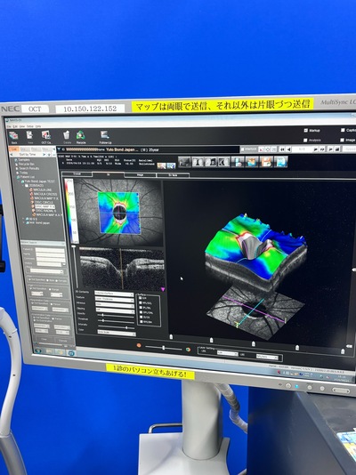 ANGIOGRAPHY installed OCT&nbsp;|&nbsp;NIDEK&nbsp;|&nbsp;RS-3000 Advance