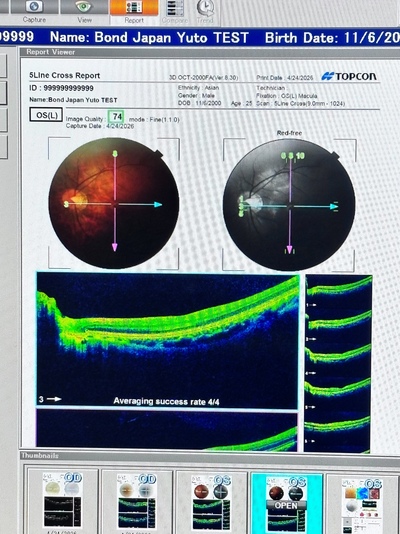 Windows 7 Pro OCT&nbsp;|&nbsp;TOPCON&nbsp;|&nbsp;3D OCT 2000 FA