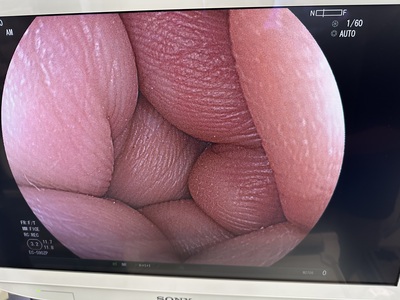 Endoscopy System&nbsp;|&nbsp;FUJIFILM&nbsp;|&nbsp;EPX-4450HD