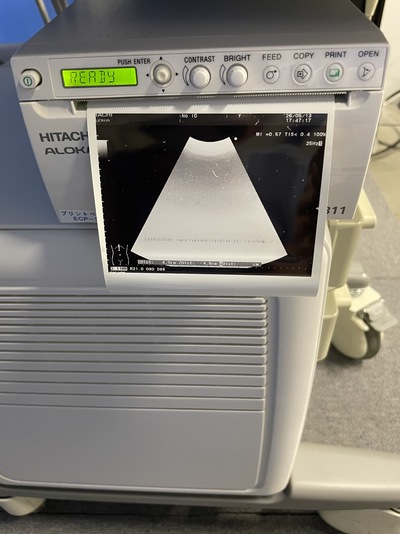 Color Doppler&nbsp;|&nbsp;HITACHI&nbsp;|&nbsp;F37