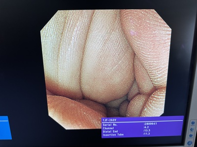 Video Duodenoscope&nbsp;|&nbsp;OLYMPUS&nbsp;|&nbsp;TJF-260V