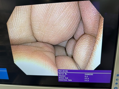 Video Colonoscope&nbsp;|&nbsp;OLYMPUS&nbsp;|&nbsp;PCF-H170I