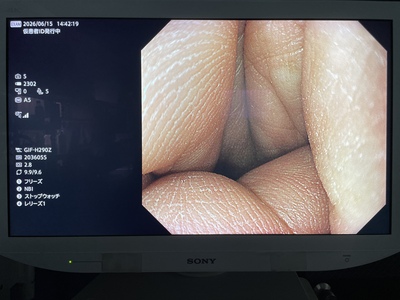 Video Gastroscope&nbsp;|&nbsp;OLYMPUS&nbsp;|&nbsp;GIF-H290Z