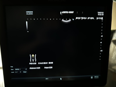 Ultrasound System&nbsp;|&nbsp;HITACHI&nbsp;|&nbsp;ARIETTA 60