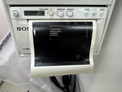 Portable Color doppler&nbsp;|&nbsp;GE&nbsp;|&nbsp;Versana Active