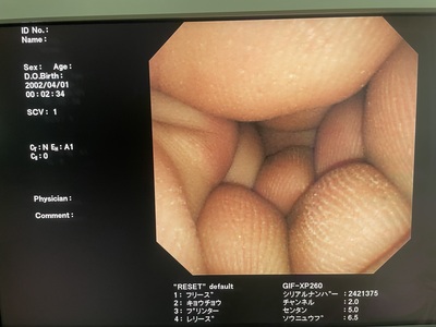 Video Gastroscope&nbsp;|&nbsp;OLYMPUS&nbsp;|&nbsp;GIF-XP260