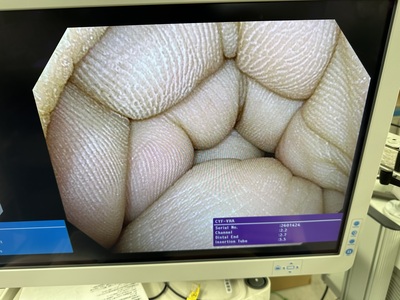 Cystoscope&nbsp;|&nbsp;OLYMPUS&nbsp;|&nbsp;CYF-VHA