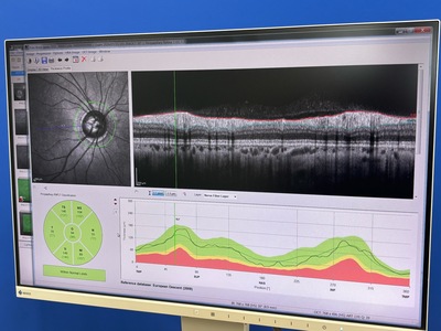 HRA2+ OCT+ WWE(55°), Retina and Glaucoma Module&nbsp;|&nbsp;Heidelberg Engineering GmbH&nbsp;|&nbsp;SPECTRALIS OCT2