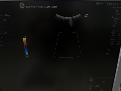 Color Doppler&nbsp;|&nbsp;GE&nbsp;|&nbsp;Logiq S7 Expert