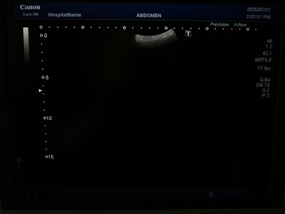 Color Doppler&nbsp;|&nbsp;CANON&nbsp;|&nbsp;Xario 200