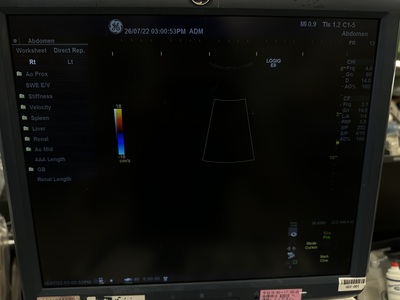 Color Doppler&nbsp;|&nbsp;GE&nbsp;|&nbsp;LOGIQ E9