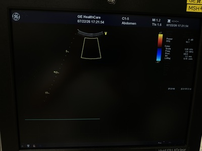 Ultrasound&nbsp;|&nbsp;GE&nbsp;|&nbsp;Vivid E9