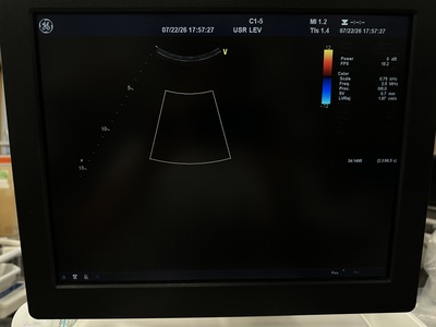 Ultrasound&nbsp;|&nbsp;GE&nbsp;|&nbsp;Vivid E9
