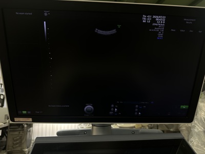 4D Ultrasound&nbsp;|&nbsp;GE&nbsp;|&nbsp;Voluson E8 BT18