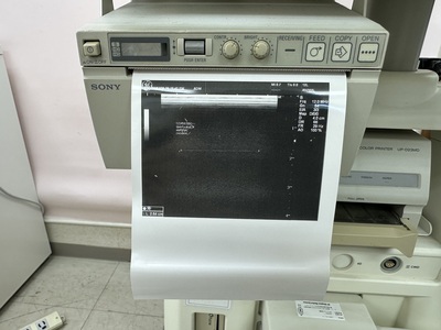 Color Doppler&nbsp;|&nbsp;GE&nbsp;|&nbsp;LOGIQ P5
