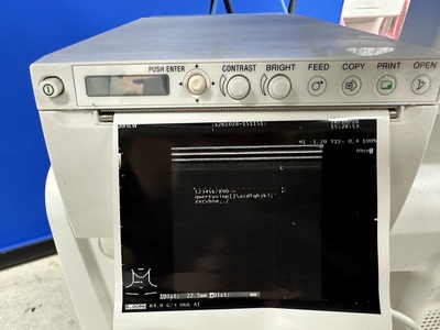 超音波診断装置&nbsp;|&nbsp;富士フィルムヘルスケア株式会社&nbsp;|&nbsp;ARIETTA 50の写真