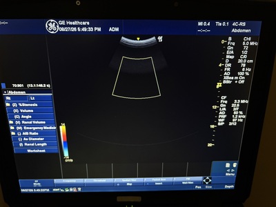Color Doppler&nbsp;|&nbsp;GE&nbsp;|&nbsp;LOGIQ e Expert