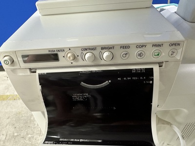 Ultrasound System&nbsp;|&nbsp;FUJIFILM&nbsp;|&nbsp;ARIETTA 50