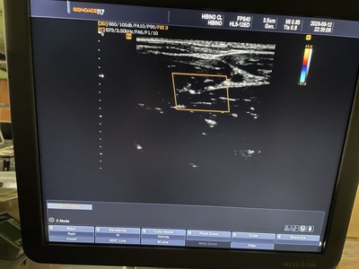 3D Ultrasound&nbsp;|&nbsp;SAMSUNG MEDISON&nbsp;|&nbsp;SonoAce R7