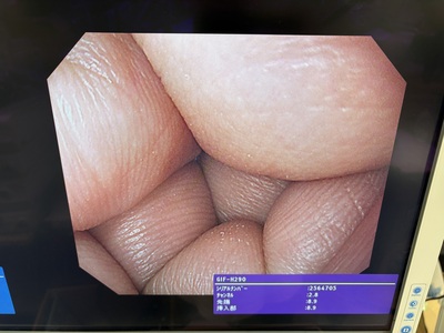 Video Gastroscope&nbsp;|&nbsp;OLYMPUS&nbsp;|&nbsp;GIF-H290