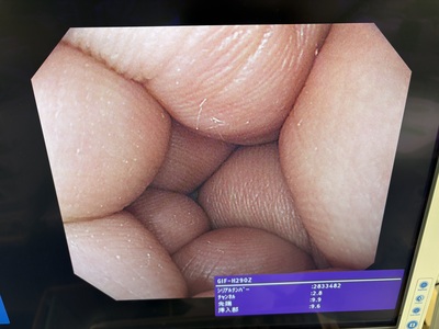 Video Gastroscope&nbsp;|&nbsp;OLYMPUS&nbsp;|&nbsp;GIF-H290Z