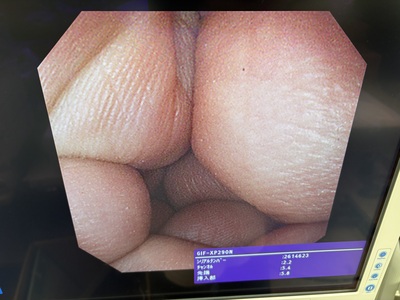 Video Gastroscope&nbsp;|&nbsp;OLYMPUS&nbsp;|&nbsp;GIF-XP290N