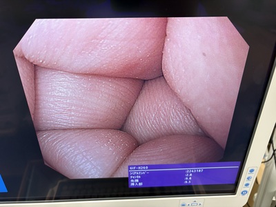 Video Gastroscope&nbsp;|&nbsp;OLYMPUS&nbsp;|&nbsp;GIF-H260