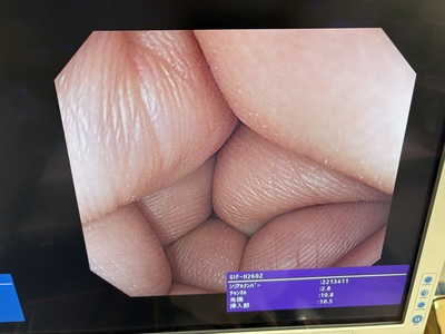 Video Gastroscope&nbsp;|&nbsp;OLYMPUS&nbsp;|&nbsp;GIF-H260Z