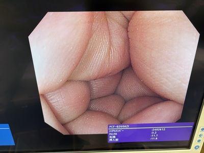 Video Colonoscope&nbsp;|&nbsp;OLYMPUS&nbsp;|&nbsp;PCF-Q260AZI