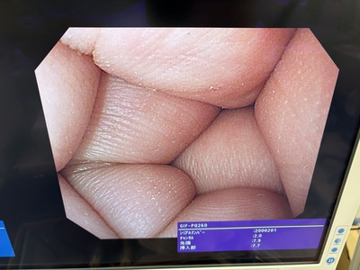 Video Gastroscope&nbsp;|&nbsp;OLYMPUS&nbsp;|&nbsp;GIF-PQ260