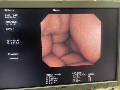 Video Colonoscope&nbsp;|&nbsp;OLYMPUS&nbsp;|&nbsp;PCF-Q260AZI