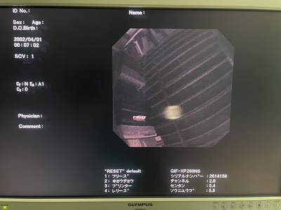 Video Gastroscope&nbsp;|&nbsp;OLYMPUS&nbsp;|&nbsp;GIF-XP260NS