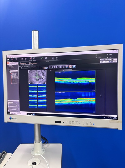 12-megapixel fundus photography × ultra-high-definition OCT&nbsp;|&nbsp;NIDEK&nbsp;|&nbsp;RS-330 Retina Scan Duo