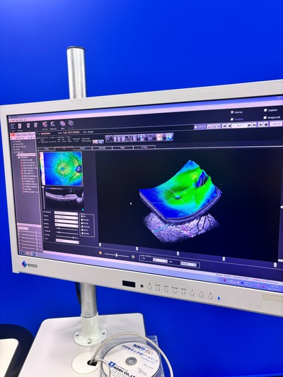 ANGIOGRAPHY Installed. No injections required. An unprecedented, high-definition 3D map of retinal blood flow drawn with light.&nbsp;|&nbsp;NIDEK&nbsp;|&nbsp;RS-3000 Advance