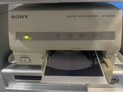 Color Doppler&nbsp;|&nbsp;GE&nbsp;|&nbsp;LOGIQ P6