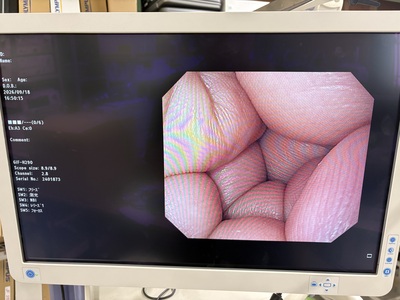Video Gastroscope&nbsp;|&nbsp;OLYMPUS&nbsp;|&nbsp;GIF-H290