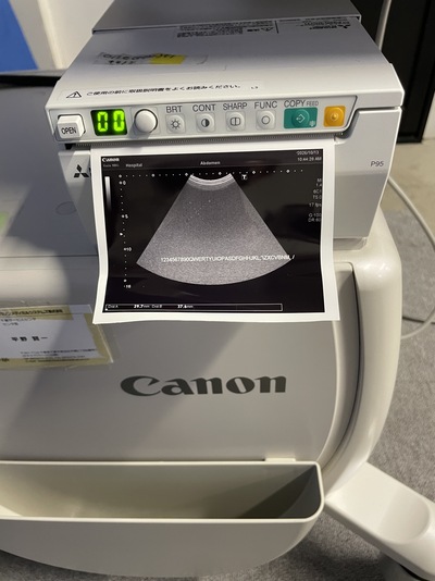 Ultrasound System&nbsp;|&nbsp;TOSHIBA&nbsp;|&nbsp;Xario 100G