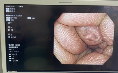 Endoscopy System&nbsp;|&nbsp;OLYMPUS&nbsp;|&nbsp;EVIS X1 CV-1500