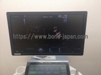 4D超音波診断装置/カラードプラ&nbsp;|&nbsp;GEヘルスケア・ジャパン株式会社&nbsp;|&nbsp;Voluson E10の写真