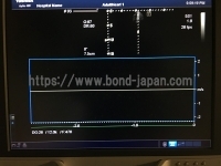 超音波診断装置/カラードプラ&nbsp;|&nbsp;キャノンメディカル株式会社&nbsp;|&nbsp;Aplio 400の写真
