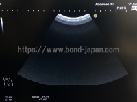 Color Doppler&nbsp;|&nbsp;HITACHI&nbsp;|&nbsp;Hi Vision Avius